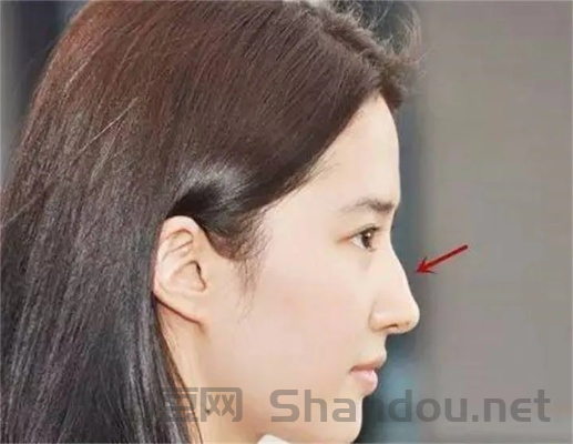 中国最罕见的鼻子，中国最美鼻子
